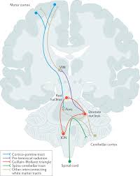 Image result for Essential Tremor