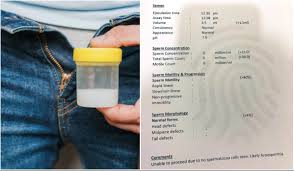 Selalu juga aku dengar orang cakap macam ni, sekarang ni kurus. Suami Baru Tahu Alami Azoospermia Lepas 5 Tahun Berkahwin Rupanya Air Mani Tiada Benih