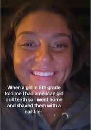 Fixing Buck Teeth: Effective Methods Explained