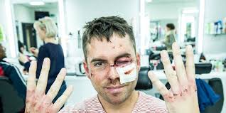 Corrie: See injured Todd Grimshaw