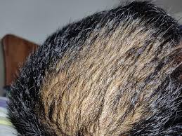 If i pull on the small hair itself after pulling it out it turns into several more really small pieces sometimes, and other times the little hair will simply break in half. Foxlt7c0a Khfm