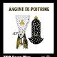 TRP Deep Dive: Angine de Poitrine