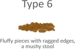 size shape and consistency of your poo what could this