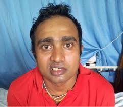 Second day of illness—left lower motor facial nerve palsy showing...