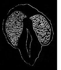 Image result for Erythrocephalum decipiens