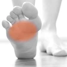 There are 126 suppliers who sells metatarsal pads metatarsalgia on alibaba.com, mainly located in asia. Metatarsalgia And The Best Home Treatment Protocol