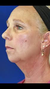 Dr. Gregory M.Casey D.D.S. M.D (@caseycosmeticsurgery)