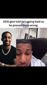 DDG tells his fans he’s not losing hair, do you see it?