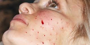 Botox" for The Face Magazine. Photographed by Rosie Marks.