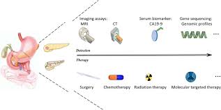 Learn about pancreatic cancer diagnosis tests here. Glycometabolic Rearrangements Aerobic Glycolysis In Pancreatic Cancer Causes Characteristics And Clinical Applications Journal Of Experimental Clinical Cancer Research Full Text