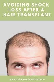 This hair loss is caused by the shock the scalp experienced during the surgery. If You Are Suffering From Hair Loss Or Baldness And Considering To Undergo A Hair Transplant Procedure Treat Hair Loss Vitamins For Hair Loss Hair Transplant