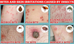 Image result for mite bites on humans