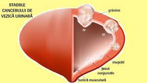 See how the tissues and organs in your body are working. Ce Este Pet Ct È™i Cum AjutÄƒ AceastÄƒ Tehnologie In Cancer