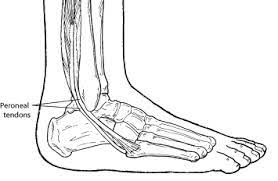 While you are still treating bunions, it is best to avoid narrow and tight shoes. Peroneal Tendon Injuries Outer Foot Pain Foot Health Facts Foot Health Facts