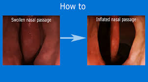 After 20 seconds, you'll feel your sinuses start to . A Technique To Decongest A Stuffy Nose Asap