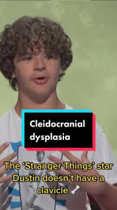 Stranger Things Star Dustin: No Collarbone Condition Explained 🦴