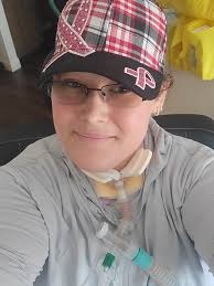 I wanted to know how many people of color had the ED surgery, and how did  it look after the healing process. I ask people of color because we are  prone to