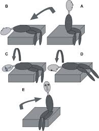 Image result for Canalith Repositioning Procedure