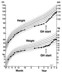 typical growth chart of an 8 year old girl with sod absence