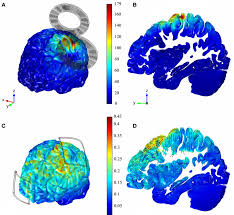 We're able to instantly jump into a virtual. Tes Vs Tms Pros And Cons Of The Two Techniques Neuroelectrics Blog Latest News About Eeg Brain Stimulation