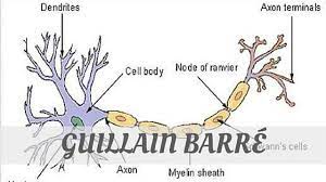 Pronounce Guillain Barre With Audio Phoneticsguillain Barre Pronunciation