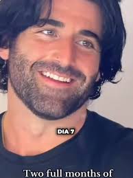 La triste realidad de los hombres lampiños