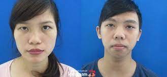 Súp gà chanh là món không thể bỏ qua khi đến hy lạp. Máº¯t Bá»‹ Sá»¥p Mi Sau Khi Ngá»§ Dáº­y Nguyen Nhan Cach Xá»­ Ly Dá»©t Ä'iá»ƒm