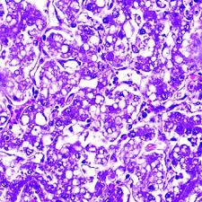 Image result for Crotalaria argyrolobioides