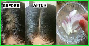 Pin On Hair Growth