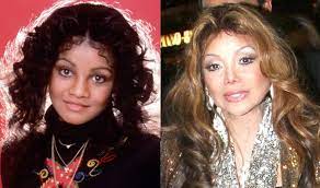 Maybe you would like to learn more about one of these? Worst Celebrity Plastic Surgery Fails 15 Chinadaily Com Cn