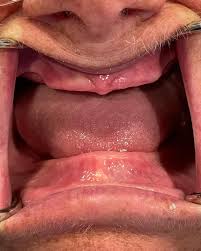 Profile para sa American Dental Excellence