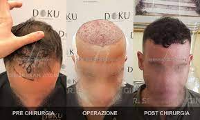 A hurricane and marketing woes couldn't keep these persistent franchisees down. Dr Serkan Aygin Trapianto Capelli Turchia