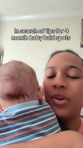 4 Month Old Bald Spot
