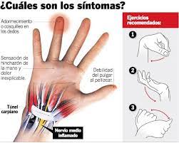 Uzivatel Cgcfe Na Twitteru Adormecimiento Y Cosquilleo En Los Dedos Sintomas Del Sindrome Del Tunel Carpiano Compartimos Esta Infografia Via Equipodelatorre Https T Co S9q4djvock Twitter