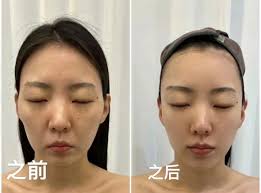 Photo by Sg.Nails.Eyelash (@mooilove_beauty_studio) · May 8, 2024