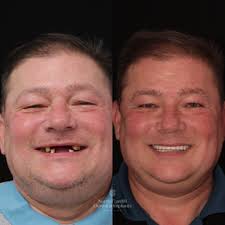 Award Winning Dentist in Cardiff