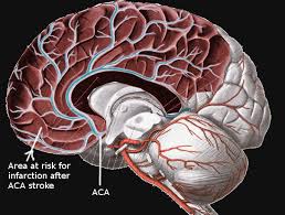We did not find results for: Figure Anterior Cerebral Artery Stroke Image Courtesy S Bhimji Md Statpearls Ncbi Bookshelf