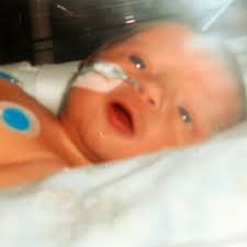 Pain, especially at the top right of the abdominal area, near the right shoulder blade, or in the back. Baby Diagnosed With Cancer Aged Just Two Hours Old After Midwife Spots Signs Of Liver Disease Mirror Online