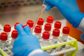 Check spelling or type a new query. Coronavirus Federal Prisons Expand Testing For Asymptomatic Inmates