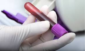 Health systems will begin using it this year. Blood Test Could Predict Response To New Breast Cancer Treatment