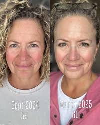 Truly's Purple Rain Glow Serum after dermaplaning