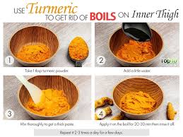 How To Get Rid Of Boils On Inner Thigh Top 10 Home Remedies Get Rid Of Boils Boil Remedies Inner Thigh Boils