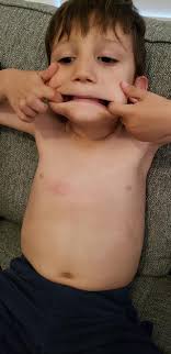 What are toddler safe bug repellents or natural deterrents for mosquitoes?