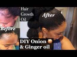 Onion Oil To Grow Bald Edges Grow Your Edges Back Fast Natural Hair Youtu Natural Hair Styles Protective Hairstyles For Natural Hair Protective Hairstyle