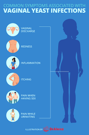 Yeast Infection vs Herpes: How Do Yeast Infection and Herpes Compare