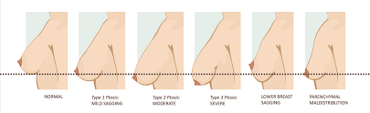 Cosmetic Surgery Trends Worth Considering In 2023, Top Cosmetic Surgery  Procedures 2023