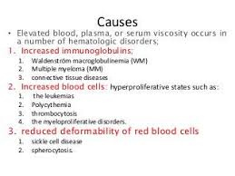 Image result for Hyperviscosity Syndrome
