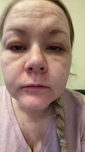 I'm honestly a bit shaken up at the moment and not really sure what to  think 😔 It all started with what looked like a small rash