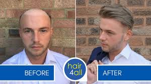 Some shops offer primarily services for hair, such as cuts, styling and color. How To Apply Attach A Non Surgical Hair Replacement System For Men With The Harris Brothers Youtube