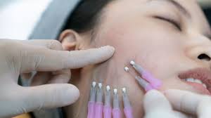 ADVANCED ANTI-AGING CENTER OF EXCELLENCE